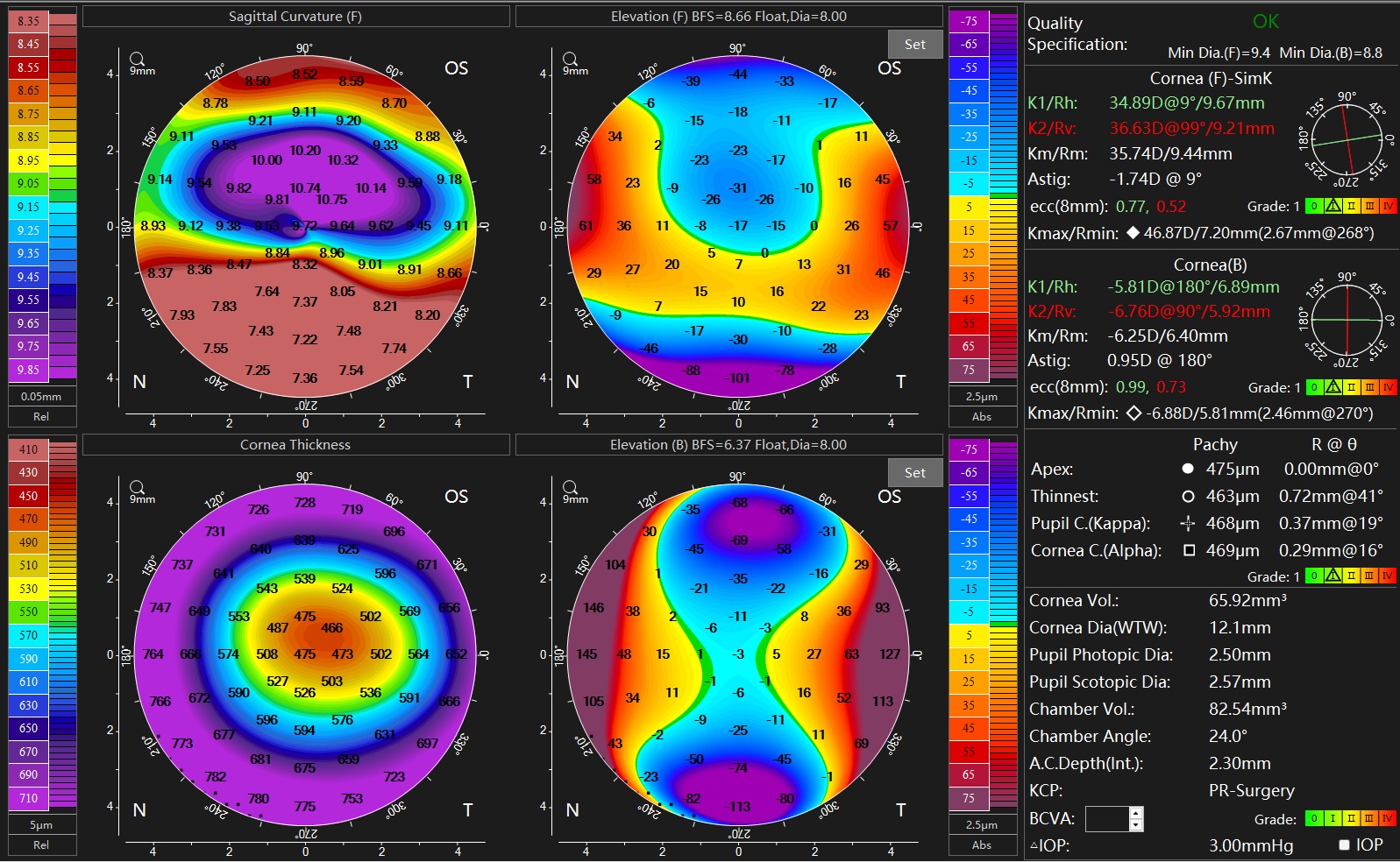 Planejamento pré e pós-operatório em cirurgia refrativa